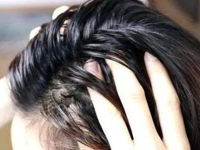 怎么给头发去油?头发油的快速解决方法