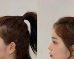 发际线高的女生什么发型好看 DIY小妙招和微秃女孩说拜拜