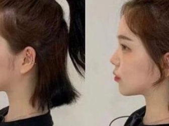 发际线高的女生什么发型好看 DIY小妙招和微秃女孩说拜拜