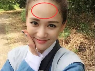 发际线过高后移适合什么发型 巧用刘海高发际线