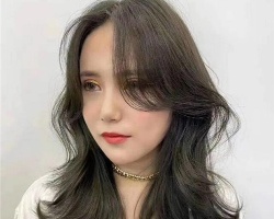发际线后移怎么预防 发际线后移怎么办