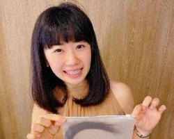 福原爱剪去长发捐赠给需要的人 粉丝大赞她新造型更减龄
