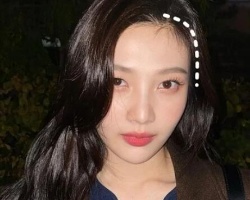 改变发际线换张脸！换了发际线之后、整个人颜值大增