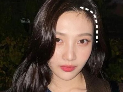改变发际线换张脸！换了发际线之后、整个人颜