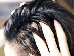 怎么给头发去油？头发油的快速解决方法