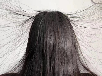 为什么秋冬头发爱起静电 怎么避免静电对头发的伤害
