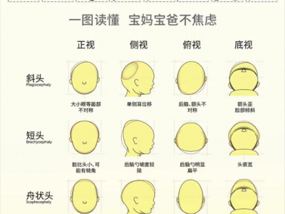 宝宝常见头型问题 各种扁平头怎么改善
